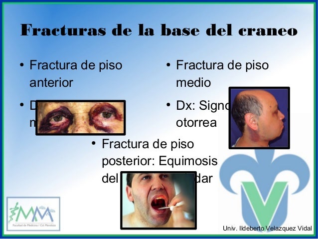 Traumatismo craneoencefalico en el adulto mayor n.n