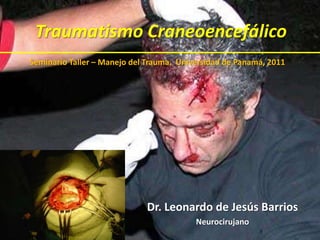 Traumatismo Craneoencefálico
Seminario Taller – Manejo del Trauma. Universidad de Panamá, 2011




                             Dr. Leonardo de Jesús Barrios
                                          Neurocirujano
 