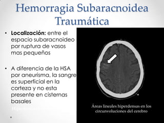 Hemorragia Subaracnoidea
Traumática
• Localización: entre el
espacio subaracnoideo
por ruptura de vasos
mas pequeños
• A diferencia de la HSA
por aneurisma, la sangre
es superficial en la
corteza y no esta
presente en cisternas
basales Aguda
Hiperdensidad en forma de semiluna
Crónica
Hipodensidad en forma de semiluna
Áreas lineales hiperdensas en los
circunvoluciones del cerebro
 