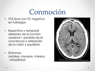 Conmoción
• TCE leve con TC negativa
en hallazgos
• Repentino y temporal
deterioro de la función
cerebral + perdida de la
conciencia o alteración
de la visión y equilibrio
• Síntomas:
cefalea, nauseas, mareos
, irritabilidad
 