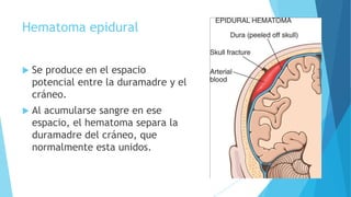 Hematoma epidural
 Se produce en el espacio
potencial entre la duramadre y el
cráneo.
 Al acumularse sangre en ese
espacio, el hematoma separa la
duramadre del cráneo, que
normalmente esta unidos.
 