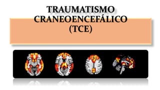 TRAUMATISMO
CRANEOENCEFÁLICO
(TCE)
 