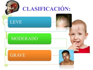 CLASIFICACIÓN:

LEVE


MODERADO


GRAVE
 