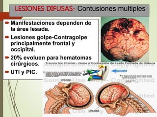 LESIONES DIFUSAS- Contusiones multiples
Manifestaciones dependen de
la área lesada.
Lesiones golpe-Contragolpe
principalmente frontal y
occipital.
20% evoluen para hematomas
cirúrgicos.
UTI y PIC.
 