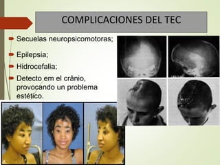 COMPLICACIONES DEL TEC
.
 Secuelas neuropsicomotoras;
 Epilepsia;
 Hidrocefalia;
 Detecto em el crânio,
provocando un problema
estético.
.
.
 