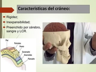 Caracteristicas del cráneo:
 Rigidez;
 Inexpansibilidad;
 Preenchido por cérebro,
sangre y LCR.
 