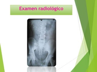 Examen radiológico

 