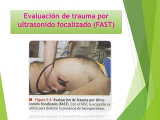 Evaluación de trauma por
ultrasonido focalizado (FAST)

 