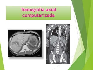 Tomografía axial
computarizada

 