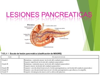 LESIONES PANCREATICAS

 