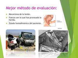Mejor método de evaluación:


Mecanismo de la lesión.



Fuerza con la cual fue provocada la
herida.



Estado hemodinámico del paciente.

 