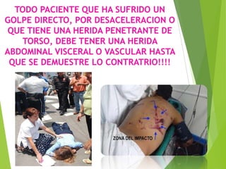 TODO PACIENTE QUE HA SUFRIDO UN
GOLPE DIRECTO, POR DESACELERACION O
QUE TIENE UNA HERIDA PENETRANTE DE
TORSO, DEBE TENER UNA HERIDA
ABDOMINAL VISCERAL O VASCULAR HASTA
QUE SE DEMUESTRE LO CONTRATRIO!!!!

 