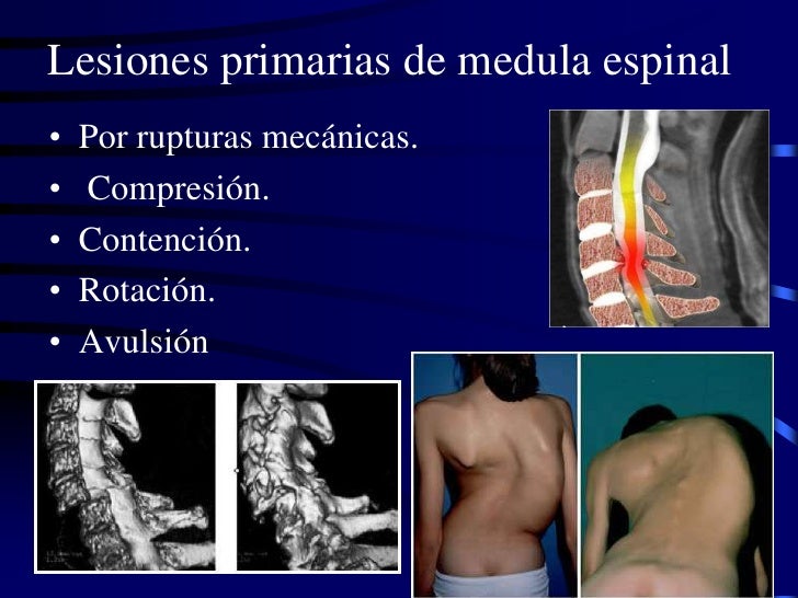 Las mialgias en los riñones los síntomas