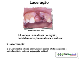 Laceração




                       (KRAMER; FELDENS, 2005)



            Limpeza, anestesia da região,
            deb...