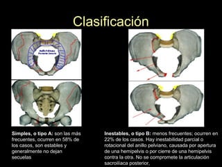 Clasificación
Simples, o tipo A: son las más
frecuentes, ocurren en 58% de
los casos, son estables y
generalmente no dejan
secuelas
Inestables, o tipo B: menos frecuentes; ocurren en
22% de los casos. Hay inestabilidad parcial o
rotacional del anillo pelviano, causada por apertura
de una hemipelvis o por cierre de una hemipelvis
contra la otra. No se compromete la articulación
sacroilíaca posterior,
 