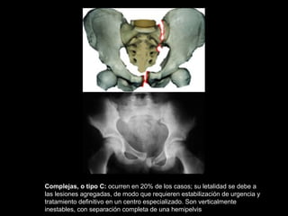 Complejas, o tipo C: ocurren en 20% de los casos; su letalidad se debe a
las lesiones agregadas, de modo que requieren estabilización de urgencia y
tratamiento definitivo en un centro especializado. Son verticalmente
inestables, con separación completa de una hemipelvis
 