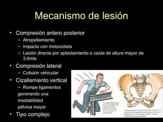 Mecanismo de lesión
• Compresión antero posterior
– Atropellamiento
– Impacto con motocicleta
– Lesión directa por aplastamiento o caída de altura mayor de
3,6mts
• Compresión lateral
– Colisión vehicular
• Cizallamiento vertical
– Rompe ligamentos
generando una
inestabilidad
pélvica mayor
• Tipo complejo
 