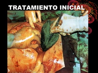 TRATAMIENTO INICIAL
 