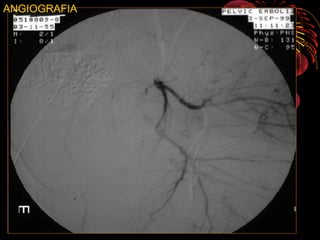 ANGIOGRAFIA
 
