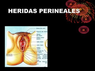 HERIDAS PERINEALES
 