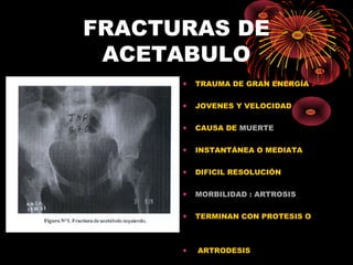 FRACTURAS DE
ACETABULO
• TRAUMA DE GRAN ENERGÍA
• JOVENES Y VELOCIDAD
• CAUSA DE MUERTE
• INSTANTÁNEA O MEDIATA
• DIFICIL RESOLUCIÓN
• MORBILIDAD : ARTROSIS
• TERMINAN CON PROTESIS O
• ARTRODESIS
 