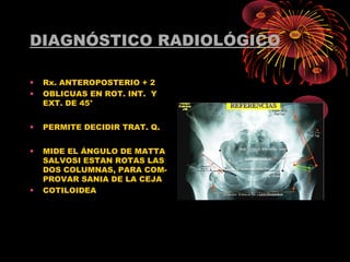 DIAGNÓSTICO RADIOLÓGICO
• Rx. ANTEROPOSTERIO + 2
• OBLICUAS EN ROT. INT. Y
EXT. DE 45°
• PERMITE DECIDIR TRAT. Q.
• MIDE EL ÁNGULO DE MATTA
SALVOSI ESTAN ROTAS LAS
DOS COLUMNAS, PARA COM-
PROVAR SANIA DE LA CEJA
• COTILOIDEA
 