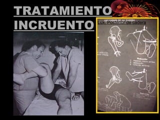 TRATAMIENTO
INCRUENTO Lux. Posterior de cadera
 