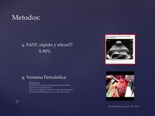  FAST: rápido y eficaz!!!
S 90%
 Ventana Pericárdica
Metodos:
 