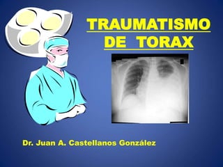 TRAUMATISMO
DE TORAX
Dr. Juan A. Castellanos González
 