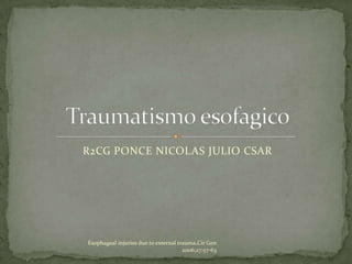 R2CG PONCE NICOLAS JULIO CSAR




Esophageal injuries due to external trauma,Cir Gen
                                      2006;27:57-63
 