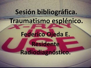 Federico Ojeda E.
Residente
Radiodiagnóstico.
Sesión bibliográfica.
Traumatismo esplénico.
 