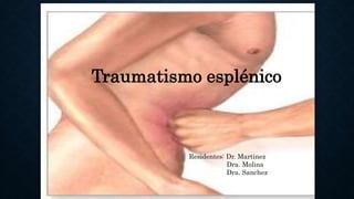 Traumatismo esplénico
Residentes: Dr. Martinez
Dra. Molina
Dra. Sanchez
 