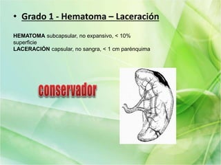 • Grado 1 - Hematoma – Laceración
HEMATOMA subcapsular, no expansivo, < 10%
superficie
LACERACIÓN capsular, no sangra, < 1 cm parénquima
 