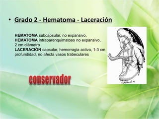 • Grado 2 - Hematoma - Laceración
HEMATOMA subcapsular, no expansivo,
HEMATOMA intraparenquimatoso no expansivo,
2 cm diámetro
LACERACIÓN capsular, hemorragia activa, 1-3 cm
profundidad, no afecta vasos trabeculares
 