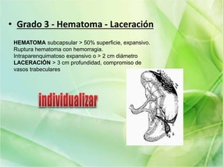 • Grado 3 - Hematoma - Laceración
HEMATOMA subcapsular > 50% superficie, expansivo.
Ruptura hematoma con hemorragia.
Intraparenquimatoso expansivo o > 2 cm diámetro
LACERACIÓN > 3 cm profundidad, compromiso de
vasos trabeculares
 