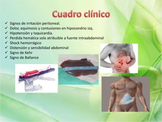  Signos de irritación peritoneal.
 Dolor, equimosis y contusiones en hipocondrio izq.
 Hipotensión y taquicardia.
 Perdida hemática solo atribuible a fuente intraabdominal
 Shock hemorrágico
 Distensión y sensibilidad abdominal
 Signo de Kehr
 Signo de Ballance
 