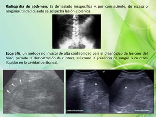 Radiografía de abdomen. Es demasiado inespecífica y, por consiguiente, de escasa o
ninguna utilidad cuando se sospecha lesión esplénica.
Ecografía, un método no invasor de alta confiabilidad para el diagnóstico de lesiones del
bazo, permite la demostración de ruptura, así como la presencia de sangre o de otros
líquidos en la cavidad peritoneal.
 
