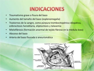 • Traumatismo grave o fisura del bazo
• Aumento del tamaño del bazo (esplenomegalia)
• Trastornos de la sangre, como púrpura trombocitopénica idiopática,
esferocitosis hereditaria, eliptocitosis y talasemia
• Mielofibrosis (formación anormal de tejido fibroso en la médula ósea)
• Absceso del bazo
• Arteria del bazo fisurada o aneurismática
 
