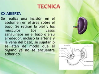 Se realiza una incisión en el
abdomen en el área sobre el
bazo. Se retiran la piel y los
músculos. Los vasos
sanguíneos en el bazo o a su
alrededor, incluso la arteria y
la vena del bazo, se sujetan o
se atan de modo que el
órgano ya no se encuentre
adherido.
 
