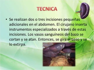 • Se realizan dos o tres incisiones pequeñas
adicionales en el abdomen. El cirujano inserta
instrumentos especializados a través de estas
incisiones. Los vasos sanguíneos del bazo se
cortan y se atan. Entonces, se gira el bazo y se
lo extirpa.
 