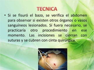 • Si se fisuró el bazo, se verifica el abdomen
para observar si existen otros órganos o vasos
sanguíneos lesionados. Sí fuera necesario, se
practicaría otro procedimiento en ese
momento. Las incisiones se cierran con
suturas y se cubren con cinta quirúrgica.
 