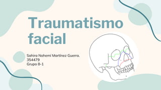 Traumatismo
facial
Sahira Nohemí Martínez Guerra.
354479
Grupo 8-1
 
