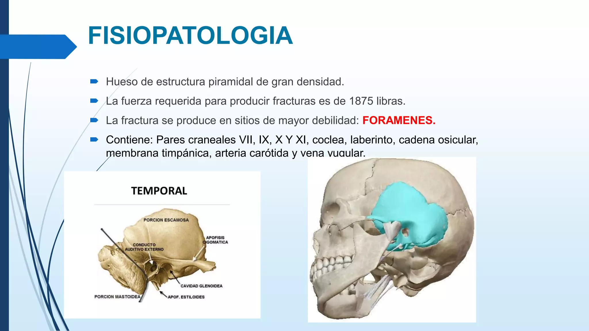 Traumatismo Hueso Temporal PPTX traumatismo-hueso-temporal-pptx