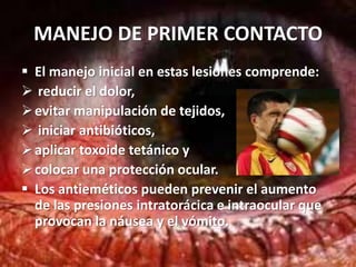 CONTUSIÓNAnte todo traumatismo contuso debe interrogarse al paciente para conocer la naturaleza y la energía del objeto contundente.PRESENTACIONESHemorragia subconjuntivalUveítis Anterior Aguda TraumáticaHifemaLesiones Traumáticas del IrisSubluxación del cristalinoLuxación del cristalinoCatarata TraumáticaConmoción retinianaHemovitreo y desgarro retinianoDiálisis RetinianaRotura CoroideaEstallido Ocular116110534127