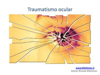 Traumatismo ocular
www.bittelman.cl
Doctor Ricardo Bittelman
 