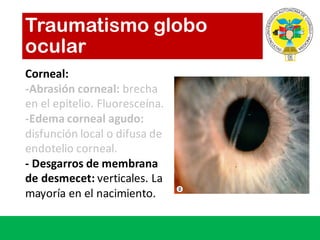 Traumatismo globo
ocular
Corneal:
-Abrasión corneal:	brecha
en	el	epitelio.	Fluoresceína.
-Edema	corneal	agudo:
disfunción local	o	difusa de	
endotelio corneal.	
- Desgarros de	membrana
de	desmecet:	verticales.	La	
mayoría en	el	nacimiento.
 