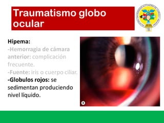 Traumatismo globo
ocular
Hipema:
-Hemorragia de	cámara
anterior:	complicación
frecuente.
-Fuente:	iris	o	cuerpo ciliar.
-Globulos rojos: se	
sedimentan produciendo
nivel líquido.
 