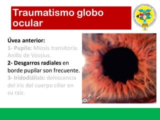 Traumatismo globo
ocular
Úvea anterior:
1- Pupila:	Miosis transitoria.	
Anillo de	Vossius.
2- Desgarros radiales en	
borde pupilar son	frecuente.
3- Iridodiálisis: dehiscencia
del	iris	del	cuerpo ciliar en	
su raíz.	
 