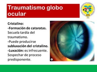 Traumatismo globo
ocular
Cristalino:	
-Formación de	cataratas.	
Secuela tardía del	
traumatismo.
-Puede producirse
subluxación del	cristalino.
-Luxación:	es infrecuente.	
Sospechar de	proceso
predisponente.
 