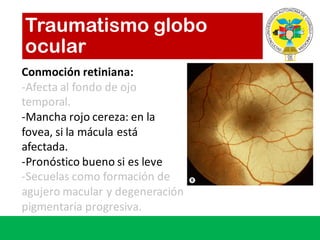 Traumatismo globo
ocular
Conmoción retiniana:	
-Afecta al	fondo de	ojo
temporal.
-Mancha	rojo cereza:	en	la	
fovea,	si la	mácula está
afectada.
-Pronóstico bueno si es leve
-Secuelas como formación de	
agujero macular	y	degeneración
pigmentaria progresiva.
 